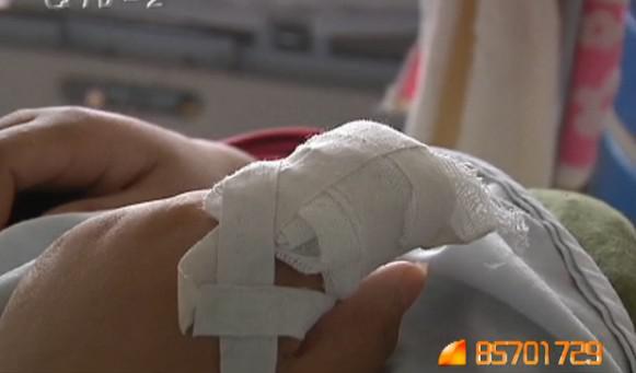 15岁少女打工时手指被截断 以为抹点药就能好