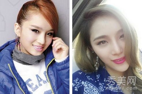 包子脸到锥子脸的蜕换 被疑整容的10大女星(图)