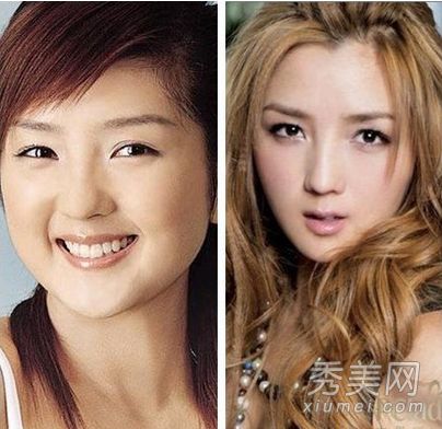 包子脸到锥子脸的蜕换 被疑整容的10大女星(图)