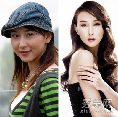 包子脸到锥子脸的蜕换 被疑整容的10大女星(图)