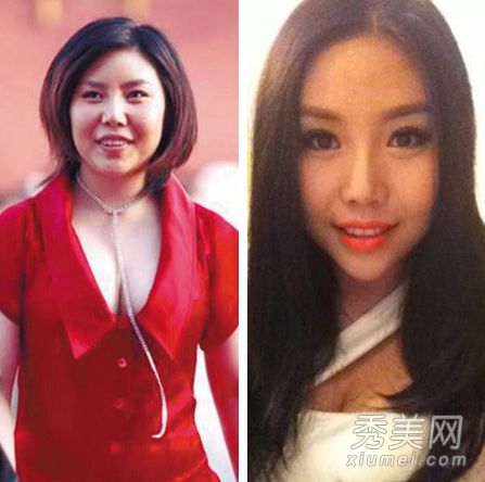 包子脸到锥子脸的蜕换 被疑整容的10大女星(图)