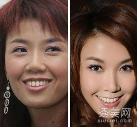 包子脸到锥子脸的蜕换 被疑整容的10大女星(图)